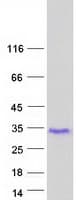 Human GAGE2C Protein (Recombinant Myc-DDK (Flag))