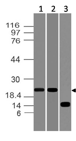 FTH1 / Ferritin Heavy Chain Antibody
