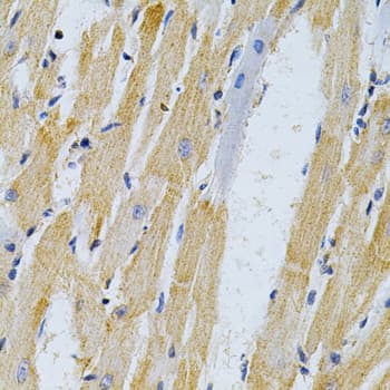 ADRBK1 / GRK2 Antibody