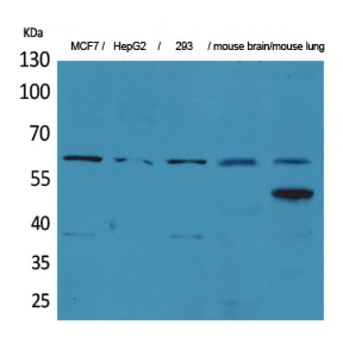 ZNF307 Antibody (Internal)
