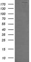 Monoclonal Mouse anti-Human DOCK8 Antibody (clone OTI2C11, aa833-1160, IF, WB)
