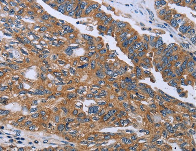GAB2 Antibody