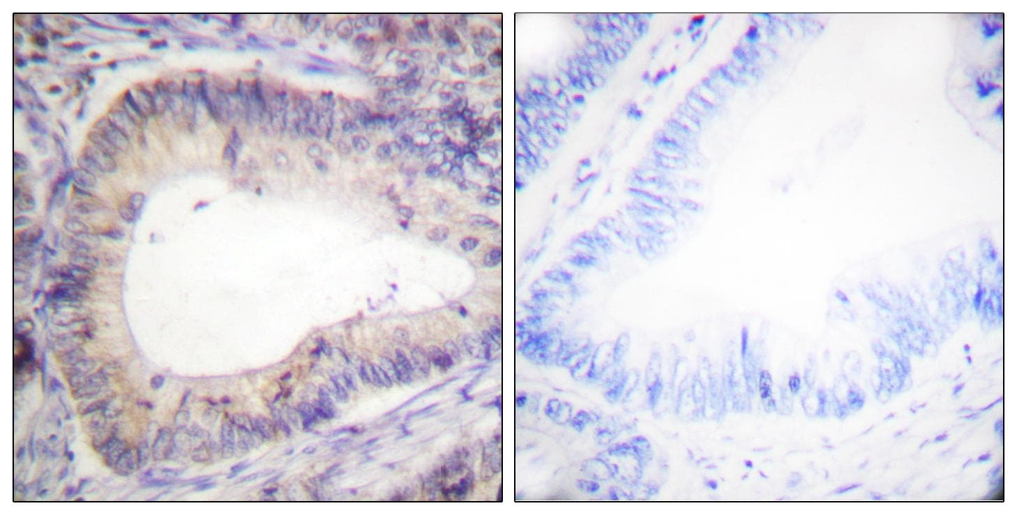 Polyclonal Rabbit anti-Human BCL2 / Bcl-2 Antibody (phospho-Thr69, IHC, IF)