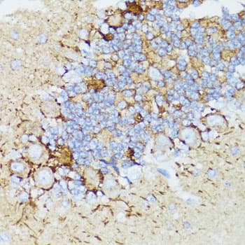 NEFH / NF-H Antibody