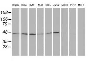 TUBB4 / Tubulin Beta 4 Antibody (clone OTI8E3)
