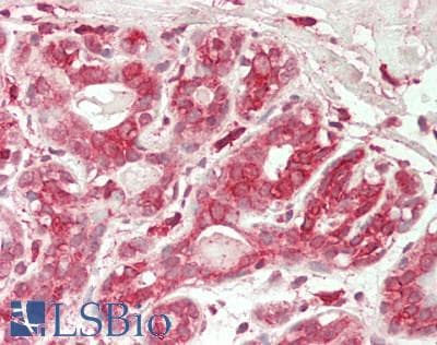 IHC-plus™ RPN2 / Ribophorin II Antibody