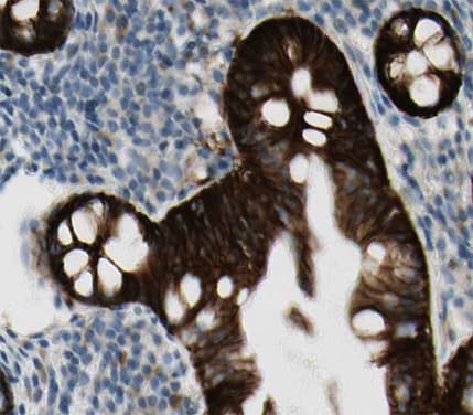 WC1 / ATP7B Antibody