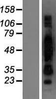 CRNN / Cornulin Protein (Over-Expression Lysate Myc-DDK (Flag))