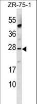 APOBEC3A Antibody (aa20-49)