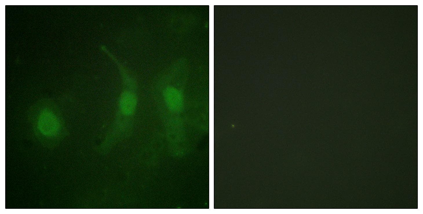 Polyclonal Rabbit anti-Human Histone H4 Antibody (Acetyl-Lys5, IHC, IF, WB)