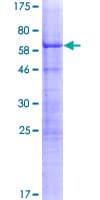 Human DPPA4 Protein (Recombinant GST)
