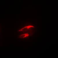 FAK / Focal Adhesion Kinase Antibody (phospho-Tyr925)