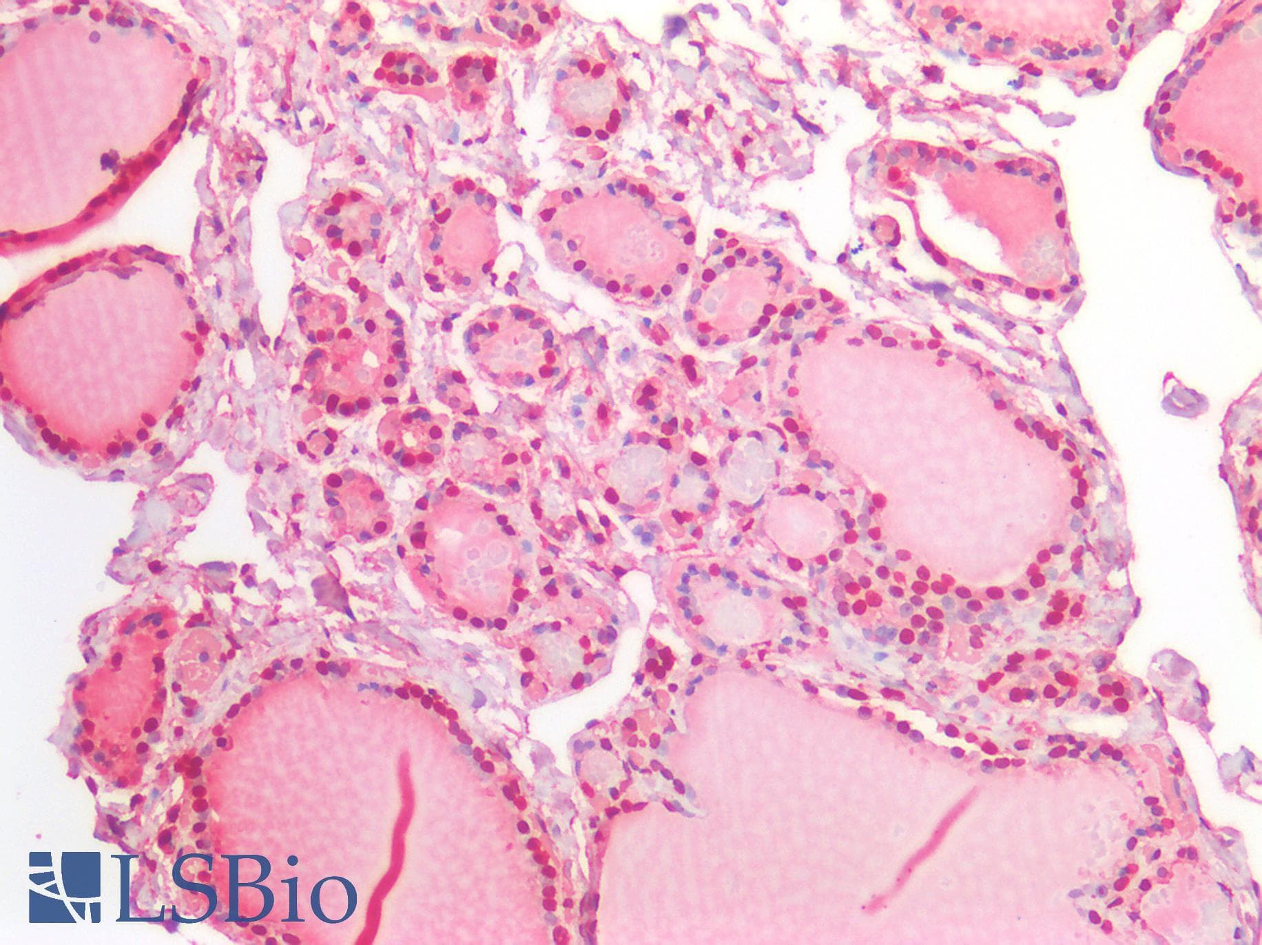 IHC-plus™ SEP15 Antibody
