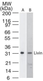 IHC-plus™ Monoclonal Mouse anti-Human BIRC7 / Livin Antibody (clone 88C570, IHC, WB)