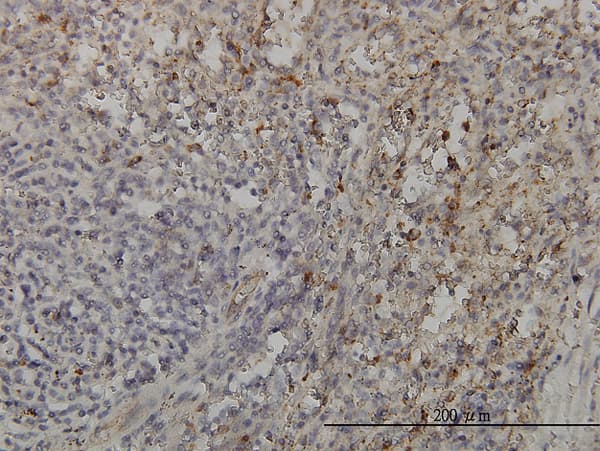 Monoclonal Mouse anti-Human GRAP2 / GRID Antibody (clone 1G12, IHC, WB)