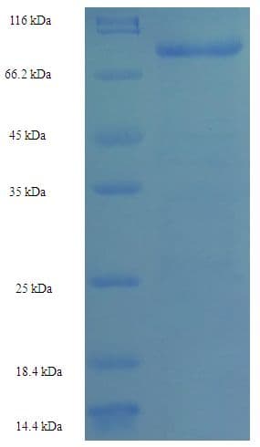 Human GALNT14 Protein (Recombinant His-SUMO)