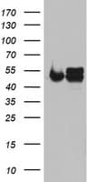Monoclonal Mouse anti-Human NDUFS2 Antibody (clone OTI2G2, aa205-463, WB)