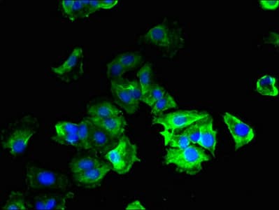 IHC-plus™ Polyclonal Rabbit anti-Human C14orf2 Antibody (IHC, WB)
