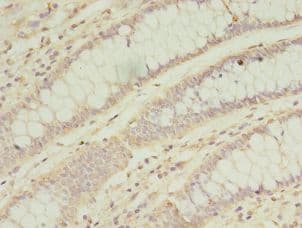 SOD2 / Mn SOD Antibody (aa64-175, Biotin)
