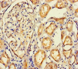IMPACT Antibody