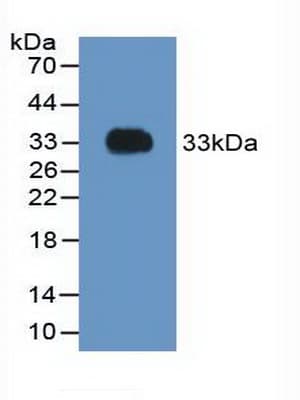 F2 / Prothrombin / Thrombin Antibody (aa324-617)