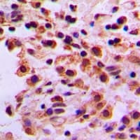 ARHGEF19 / WGEF Antibody