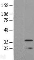 TMEM177 Protein (Over-Expression Lysate Myc-DDK (Flag))