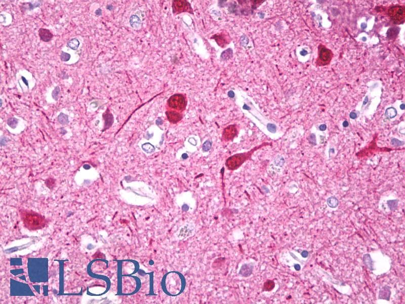 IHC-plus™ HMX3 Antibody (aa193-224)