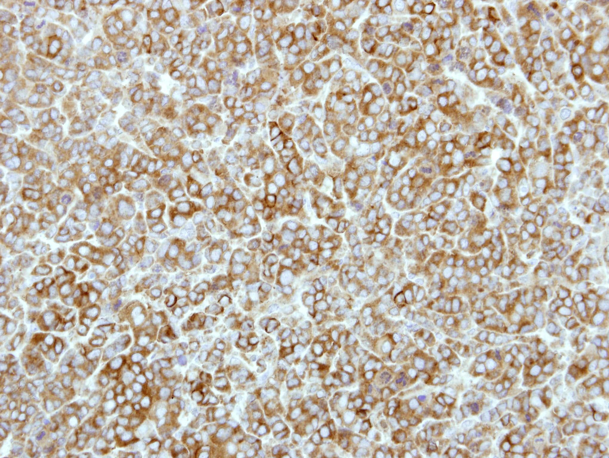 EEF2K Antibody (aa1-268)