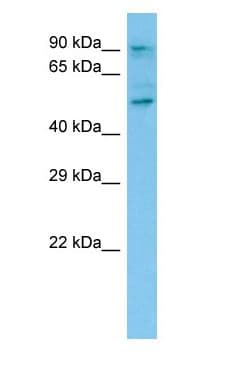 CAPRIN1 Antibody (aa581-630)
