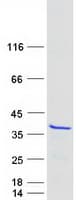 Human MEAF6 / C1orf149 Protein (Recombinant Myc-DDK (Flag))