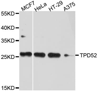 D52 / TPD52 Antibody