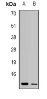 UQCR10 / UCRC Antibody