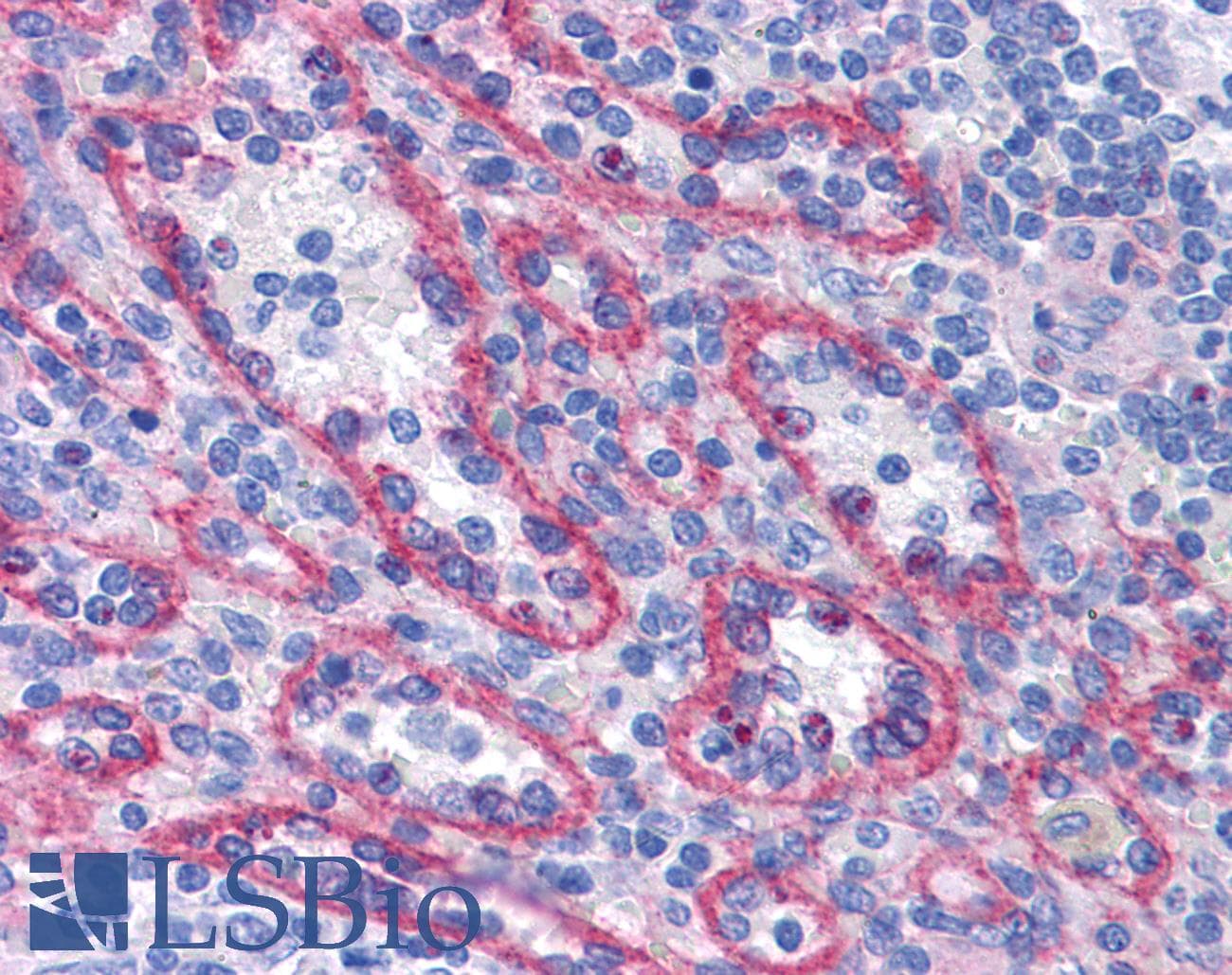 IHC-plus™ AFAP1L2 / XB130 Antibody
