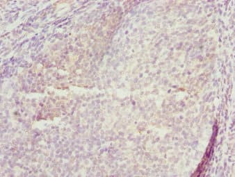 TRIM29 Antibody