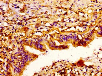 SEMA3A / Semaphorin 3A Antibody