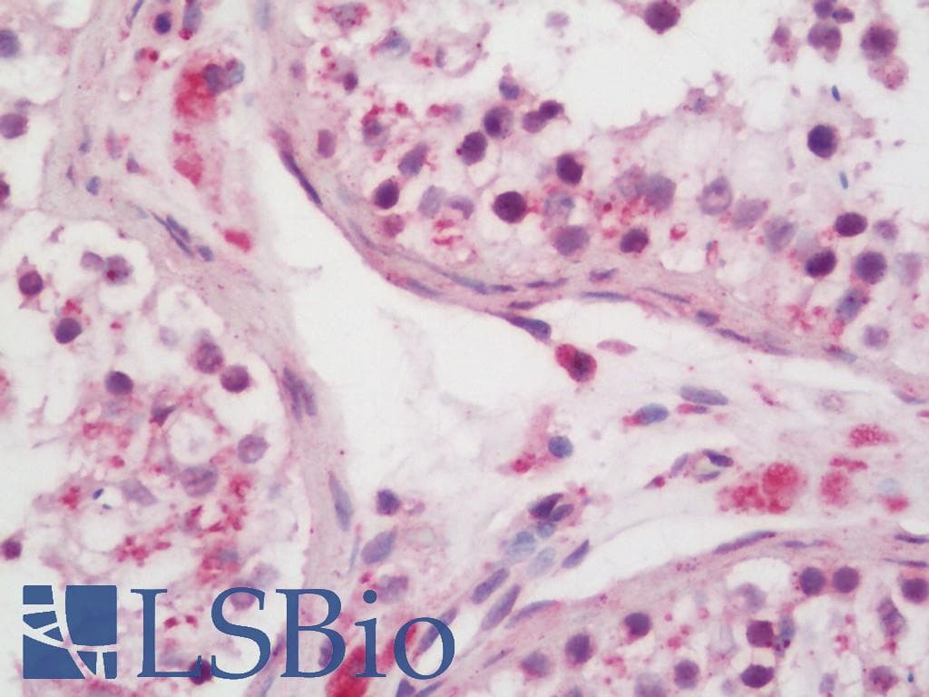IHC-plus™ Polyclonal Rabbit anti-Human NFKB2 Antibody (aa836-885, IHC, WB)