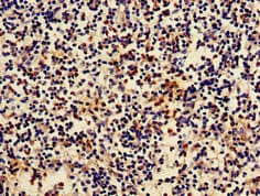 Polyclonal Rabbit anti-Human ARRB2 / Beta Arrestin 2 Antibody (IHC, IF, WB)