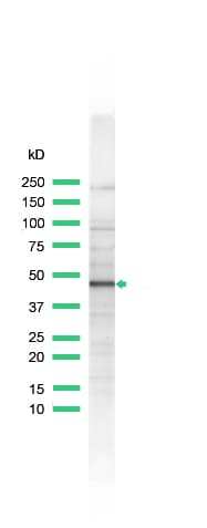 IHC-plus™ INHA / Inhibin Alpha Antibody