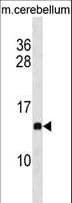 PFDN2 Antibody (aa97-125)