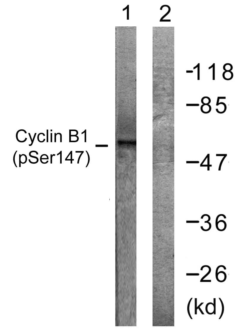 CCNB1 / Cyclin B1 Antibody (phospho-Ser147)