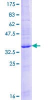 Human CD225 / IFITM1 Protein (Recombinant GST)
