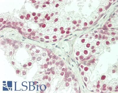 IHC-plus™ Polyclonal Rabbit anti-Human CRTC1 / MECT1 / TORC1 Antibody (aa600-C-term, IHC, WB)