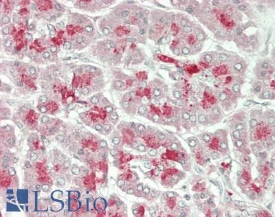 IHC-plus™ IL13RA1 / IL13R Alpha 1 Antibody
