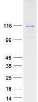 Human AXIN1 / Axin-1 Protein (Recombinant Myc-DDK (Flag))