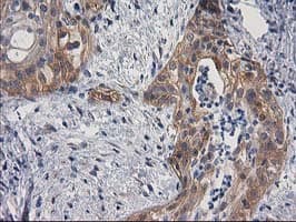 BCAR1 / p130Cas Antibody (clone OTI1A9)