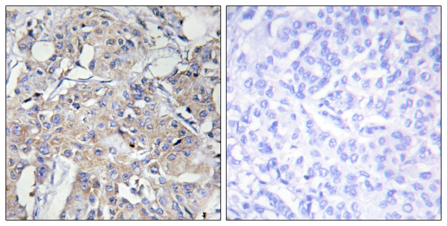Polyclonal Rabbit anti-Human COL6A3 / Collagen VI Alpha 3 Antibody (aa2261-2310, IHC, IF)
