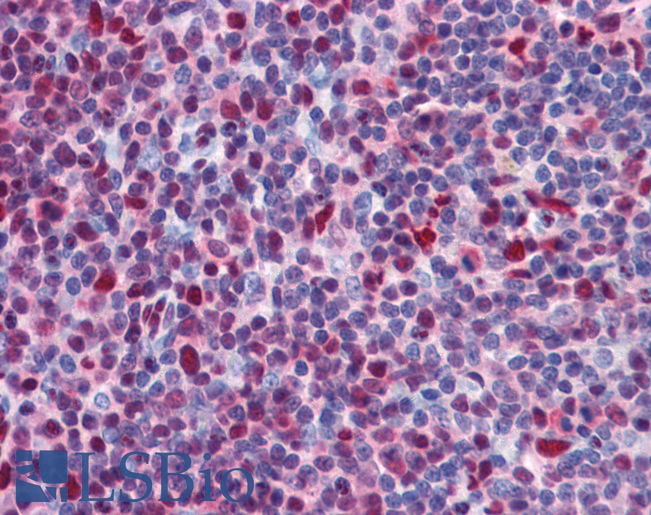 Polyclonal Rabbit anti-Human CHD4 Antibody (aa71-120, IHC, WB)