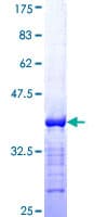 Human BCL9 Protein (Recombinant GST, N-terminus)