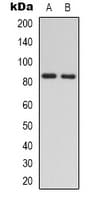 Polyclonal Rabbit anti-Human RAD54L Antibody (Internal, IHC, IF, WB)